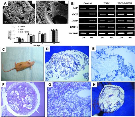 (A) SEM images of PLLA-nanofibrous scaffolds loaded with DPSCs cultured ...