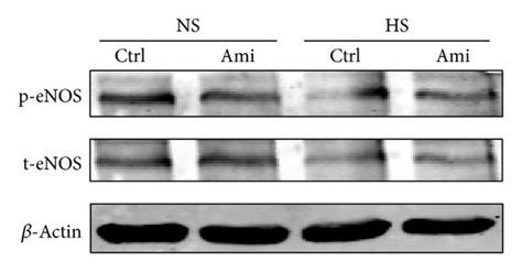 Effect Of Enac Blockade On The Phosphorylation Of Enos Ser 1177 And Download Scientific Diagram