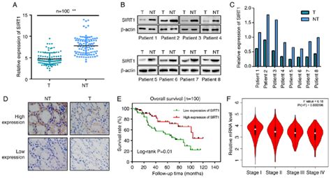 Sirt Expression Is Downregulated In Rcc Tissues Compared With In