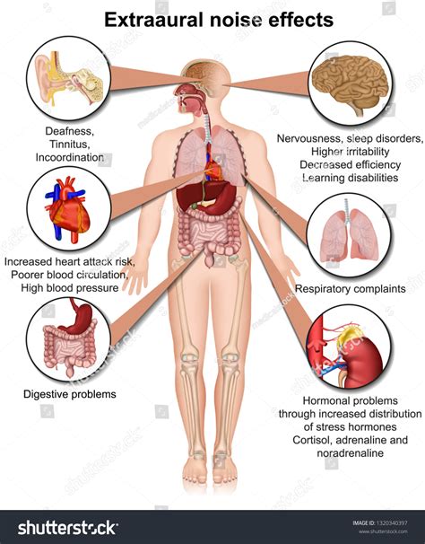 Extraaural Health Effects Chronic Noise Exposure Stock Vector (Royalty Free) 1320340397 ...