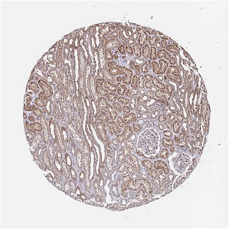 tissue expression  wnk staining  kidney  human protein atlas