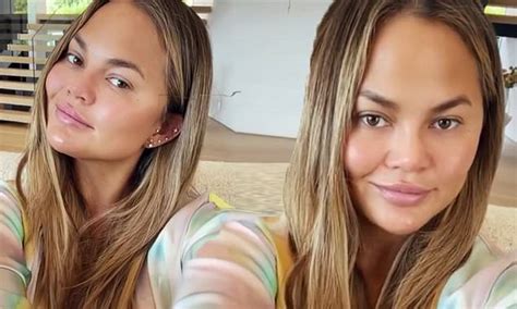 Chrissy Teigen Denies Getting Filler In Her Cheeks After Buccal Fat