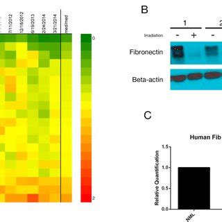 A Heat Map Of Reverse Phase Protein Array Of Paired Irradiated And