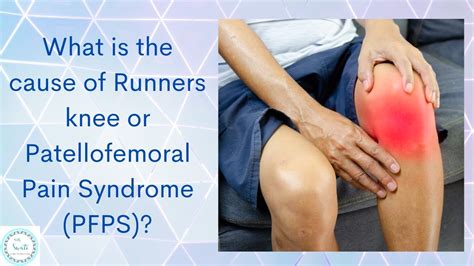 What Is The Cause Of Runners Knee Or Patellofemoral Pain Syndrome Pfps