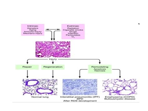 Anatomy And Physiology Of Lung Interstitium Ppt Free Download