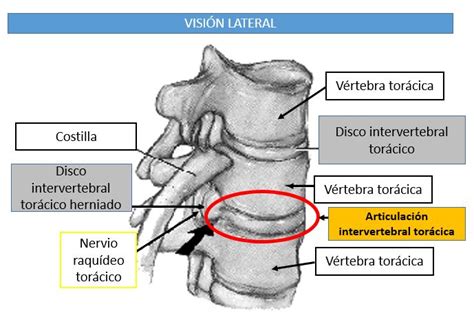 Articulaciones Intervertebrales Entre Los Cuerpos De Las V Rtebras