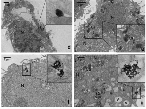 TEM Ultrastructural Analysis Of Ultrathin Sections Of A Untreated