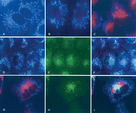 Localization Of The Photosensitizer ZnPc A Control A 549 Cells UV