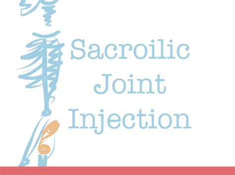 Sacroiliac Joint Injection | Complex Pain & Wellness