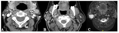 Johbm Free Full Text Beyond Ultrasound Multimodal Cross Sectional Imaging For Preoperative