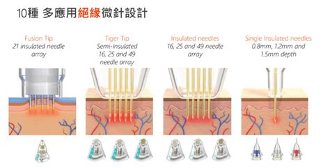 無限電波是什麼？3大特色成微針電波革命新科技！ 台中二林四季皮膚科 20skin美醫集團