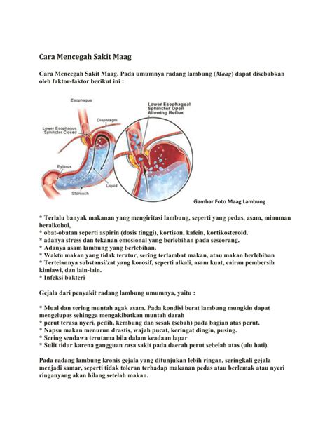 Cara Mencegah Sakit Maag