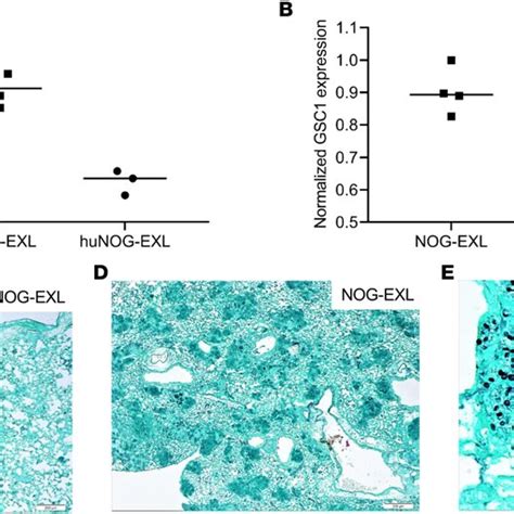 Human Lymphocytes Generated Pneumocystis Specific Human Cytokines In Download Scientific