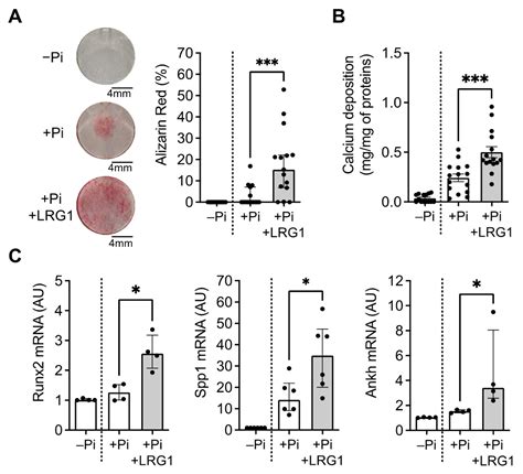 Ijms Free Full Text Leucine Rich Alpha 2 Glycoprotein 1 Accumulates