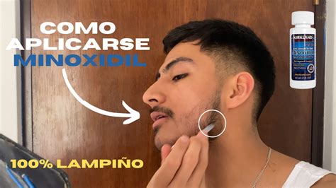 Como Aplicar Minoxidil Para Crecer Barba Youtube