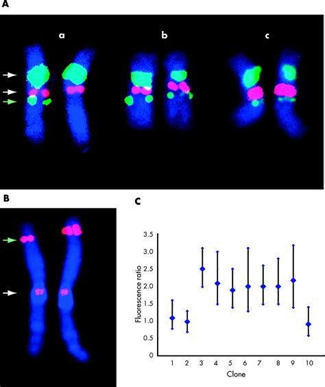 Microarray Based Comparative Genomic Hybridisation Array Cgh Detects