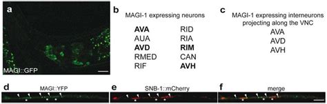 Expression Pattern And Sub Cellular Localization Of MAGI 1 GFP A