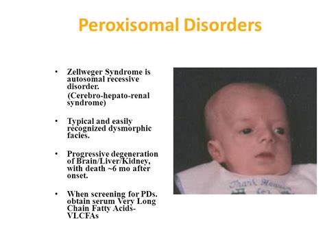 Zellweger Syndrome Peroxisomes