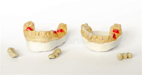 Prosthetics – generally and in detail. Dental, orthopedic and aesthetic ...