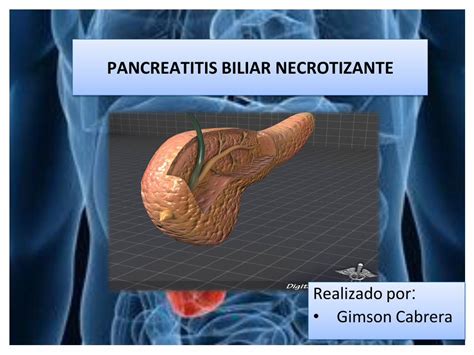 Pdf Pancreatitis Biliar Necrotizante En Ecuador La Pancreatitis