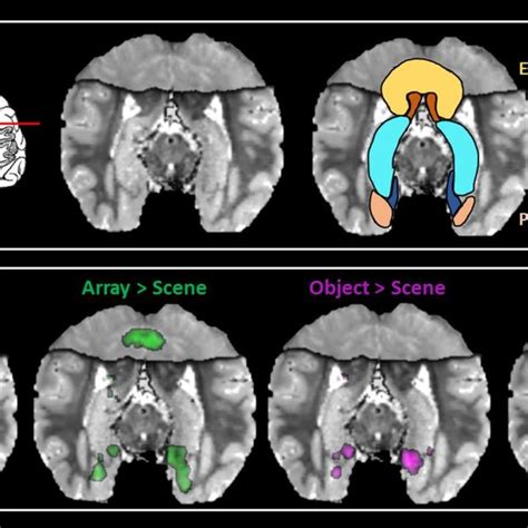 Summary of the main hippocampal activations. (A) The location of the ... 