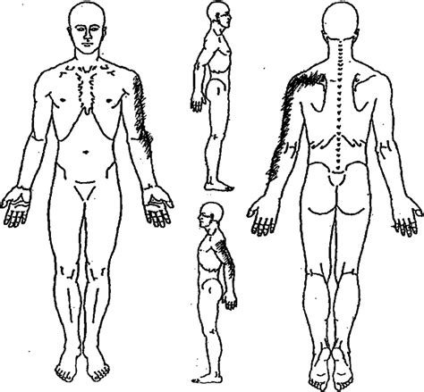 Body chart of reported pain. | Download Scientific Diagram