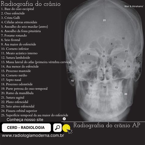 Anatomia Radiogr Fica Do Cr Nio Ap Radiologia Exames De Imagem