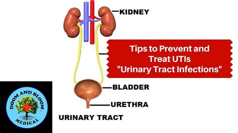 All About Utis Tips To Prevent And Treat Urinary Tract Infections Youtube