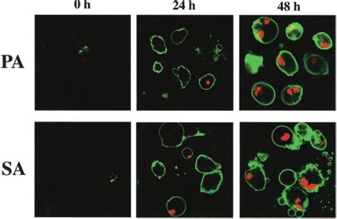 Morphological Evidence For Apoptosis Induced By Saturated FFAs After