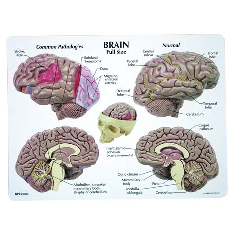 Gpi Modello Di Cervello Modello Di Cervello Umano Cervello Umano