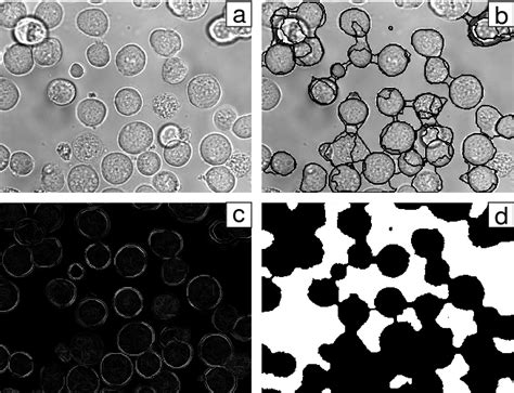 Figure 2 From Classification Of Segmented Regions In Brightfield Microscope Images Semantic