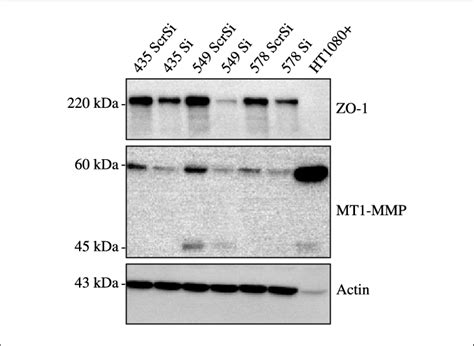 Down Regulation Of Mt1 Mmp Expression In Invasive Tumor Cell Lines By