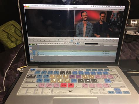 Texas - Transforaminal lumbar interbody fusion (TLIF) is spinal fusion