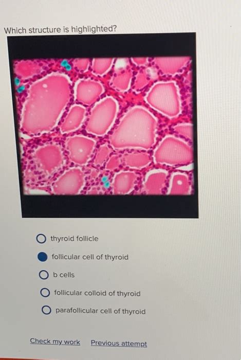 Solved Label The Photomicrograph Based On The Hints Chegg