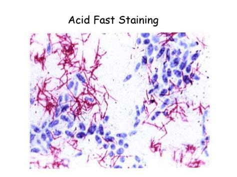 Acid Fast Stain Protocols Ziehl Neelsen Kinyoun Truant Methods