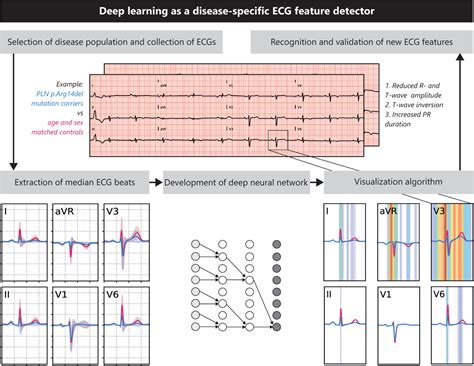 Discovering And Visualizing Disease Specific Electrocardiogram Features