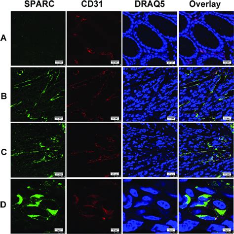 The Expression Of Sparc Protein By Vascular Endothelial Cells In Human