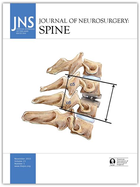 Ginkgo Leaf Sign A Highly Predictive Imaging Feature Of Spinal