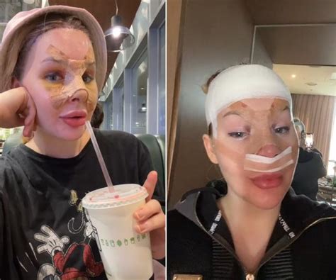 Aussie Woman Jazmyn Forrest Spends 100 000 On Cosmetic Surgeries To