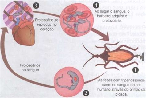 Doença De Chagas Cola Da Web