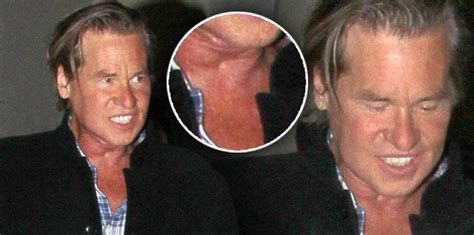 Val Kilmer Makes Huge Step On The Road To Recovery From Throat Tumor