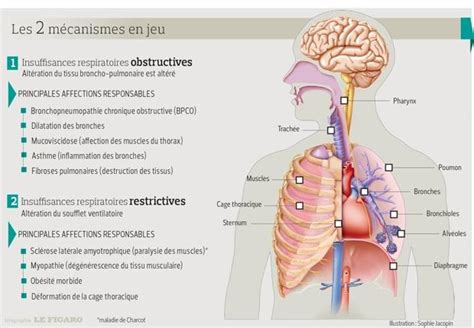 Bronches Quelles Sont Les Principales Maladies Des Bronches