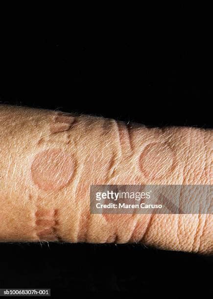 310 Skin Imprint Stock Photos High Res Pictures And Images Getty Images