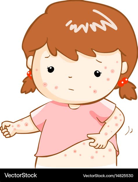 Girl Scratching Itching Rash On His Body Vector Image