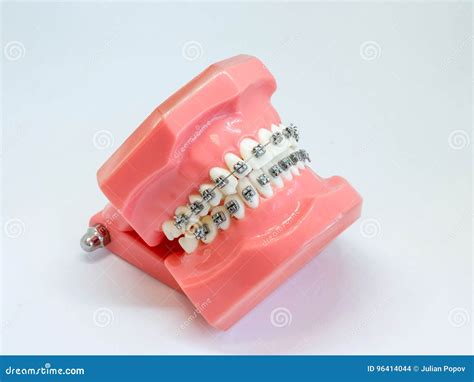 Artificial Model Of Human Jaw With Wire Colorful Braces Attached Stock