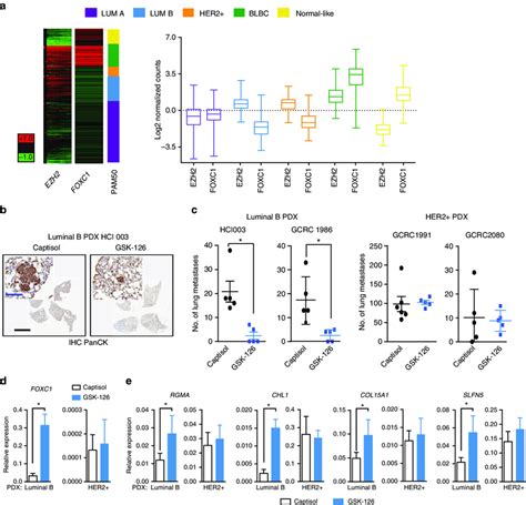 Inhibition Of Ezh2 Methyltransferase Activity Reduces The Metastatic