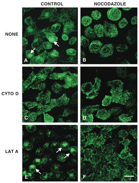 Disruption Of The Actin Cytoskeleton Blocks The Formation Of The Linear