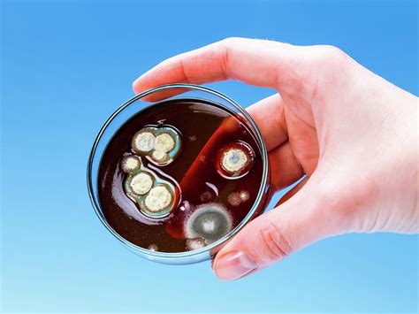 Bacterial Colonies On Petri Dish Photograph By Wladimir Bulgarscience