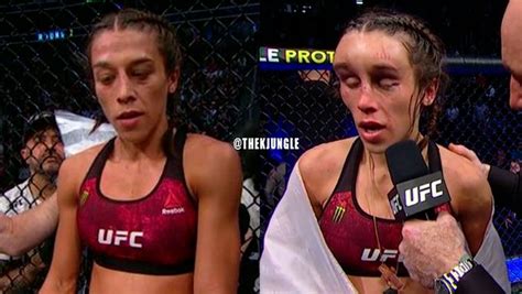 La Luchadora Joanna Jedrzejczyk Acaba Con La Cara Desfigurada Tras Un