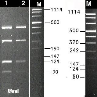 RFLP Profiles Of 16S RDNA Amplicons Obtained In Nested PCR Primed By